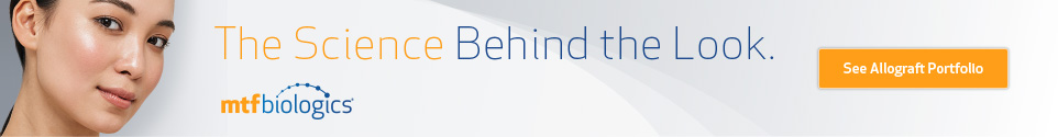 MTF Banner Ad