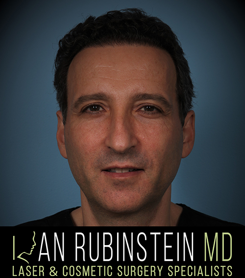 Ran Y. Rubinstein, MD